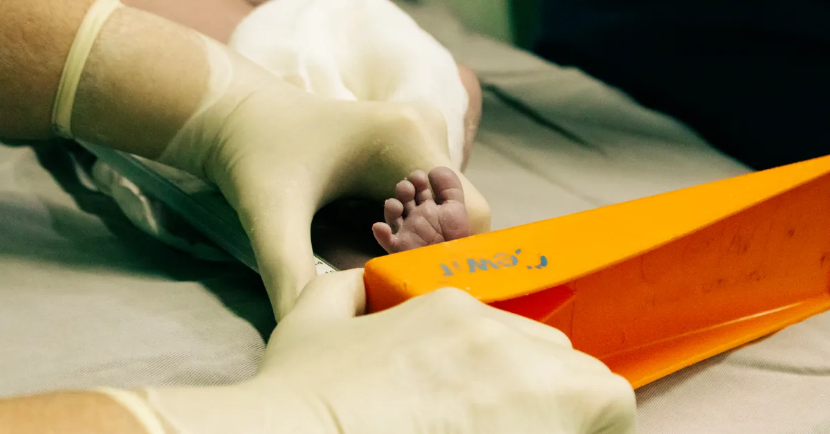 Perangkat Medis Inovatif Efferon NEO Tangani Sepsis Pada Anak Dengan Lebih Efektif