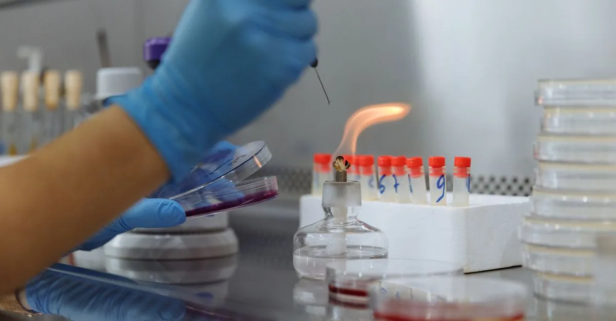 Bunsen Burner Dinilai Tidak Efektif Dalam Mensterilkan Laboratorium Modern