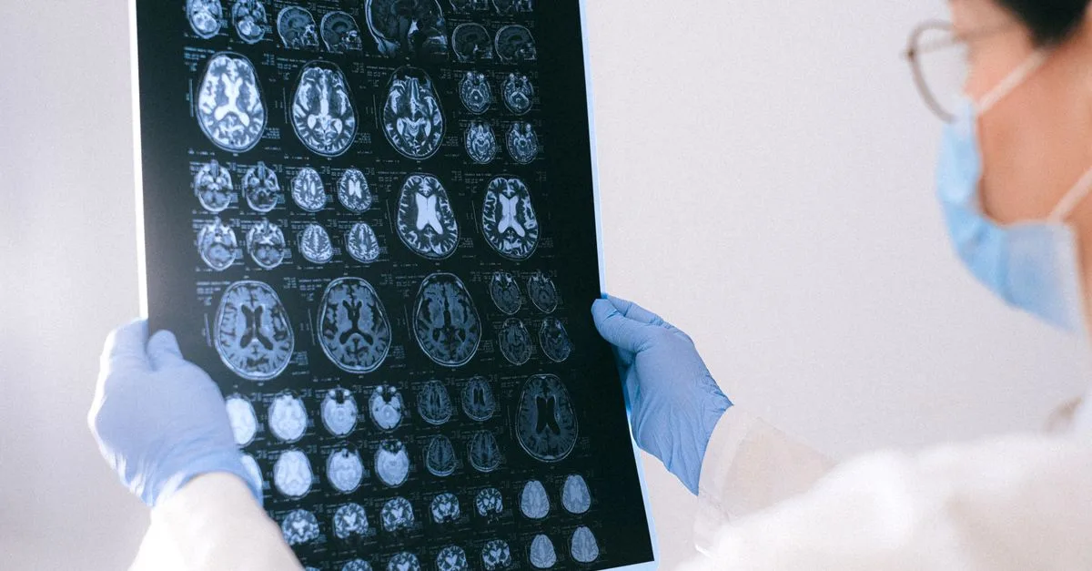 253 Elektroda Di Otak Kembalikan Bahasa Tubuh Pasien Stroke Dan ALS